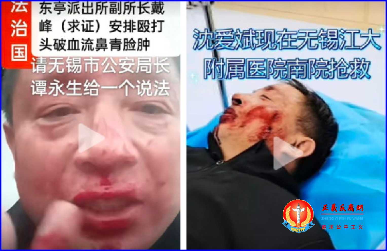 2025年10月27日,无锡转业军人沈爱斌在锡山区东亭派出所被副所长戴峰指挥十几名特勤(协警)人员将他暴打重伤住院。.jpg 2025年10月27日,无锡转业军人沈爱斌在锡山区东亭派出所被副所长戴峰指挥十几名特勤(协警)人员将他暴打重伤住院。.jpg