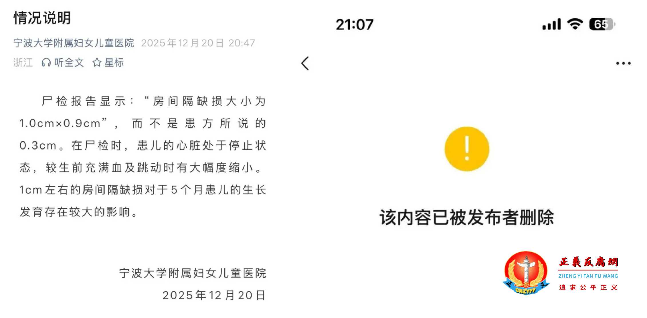 关于患儿尸检报告,宁波大学附属妇女儿童医院发布情况说明后又删了.jpg 关于患儿尸检报告,宁波大学附属妇女儿童医院发布情况说明后又删了.jpg