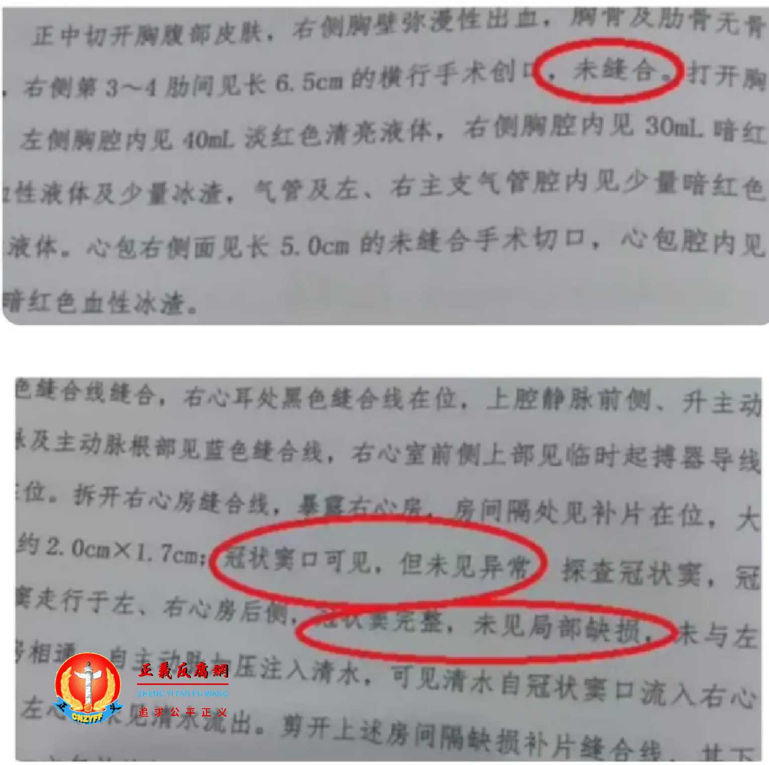 小洛熙家属发布的部分尸检报告.jpg 小洛熙家属发布的部分尸检报告.jpg