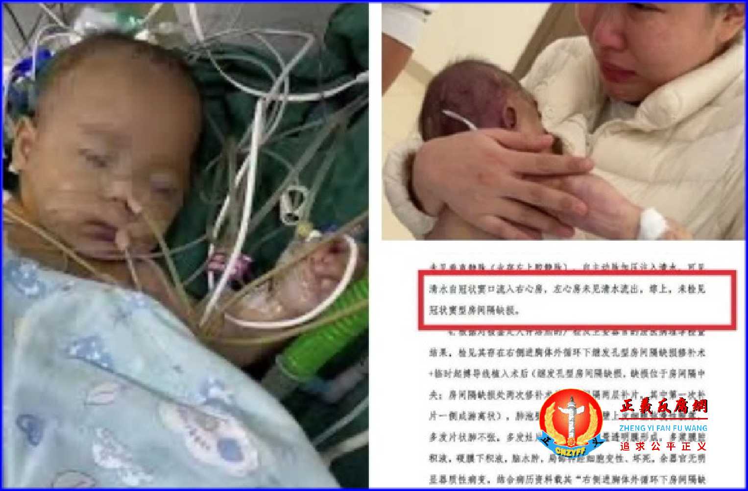 2025年12月19日,浙江宁波5月龄女婴小洛熙手术时离世的尸检报告出炉,显示手术存在重大问题。.jpg 2025年12月19日,浙江宁波5月龄女婴小洛熙手术时离世的尸检报告出炉,显示手术存在重大问题。.jpg